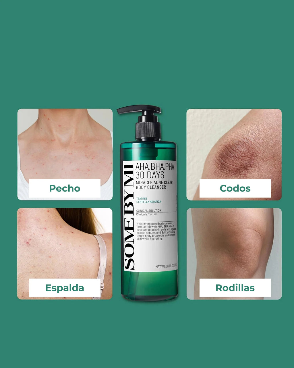 AHA BHA PHA 30 Days Miracle Acne Clear Body Cleanser